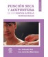 PUNCION SECA Y ACUPUNTURA