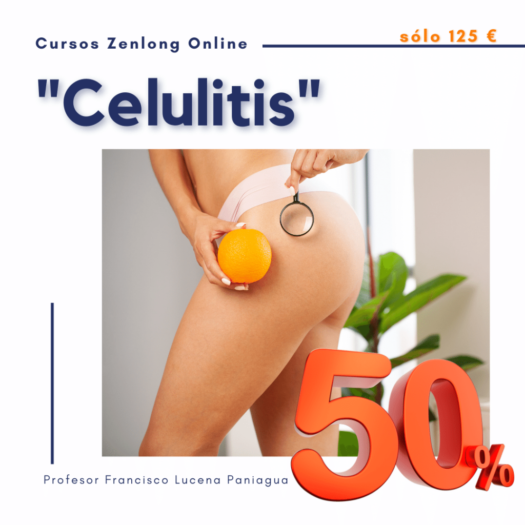 Celulitis