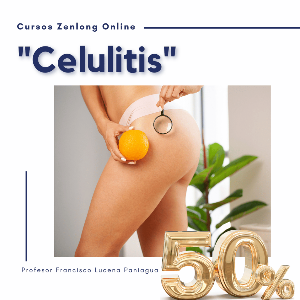 Celulitis