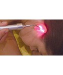 Laserpuntura Y Laserterapia