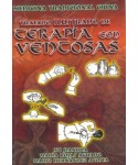 Ventosas