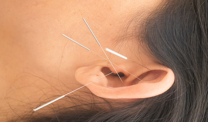 auriculoterapia