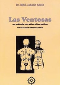 LAS VENTOSAS