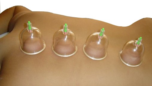 Ventosa Con Bomba De Aspiración 18uds.+4 de regalo - Imagen 4